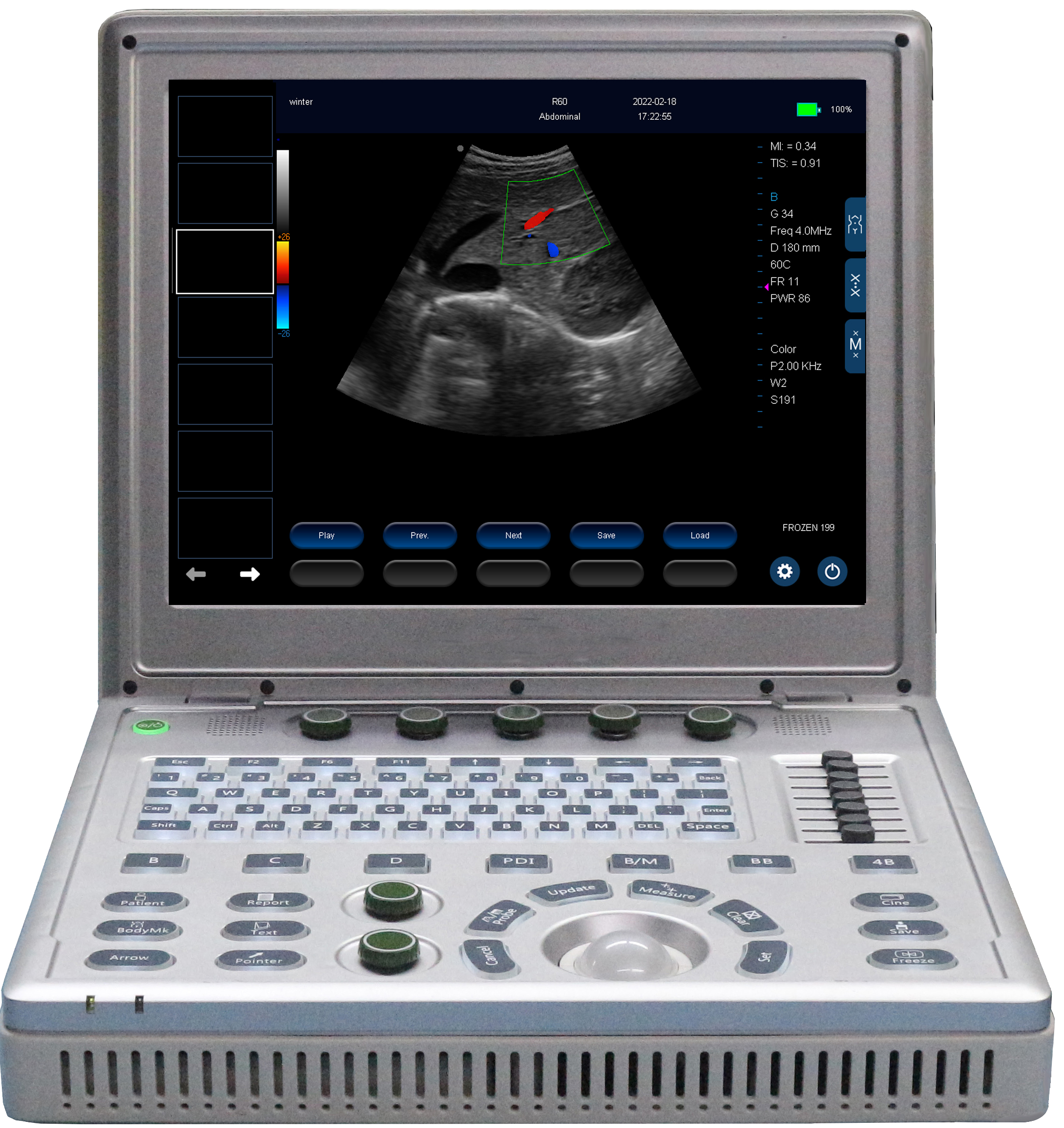 D3D3 Laptop Color Doppler Ultrasound