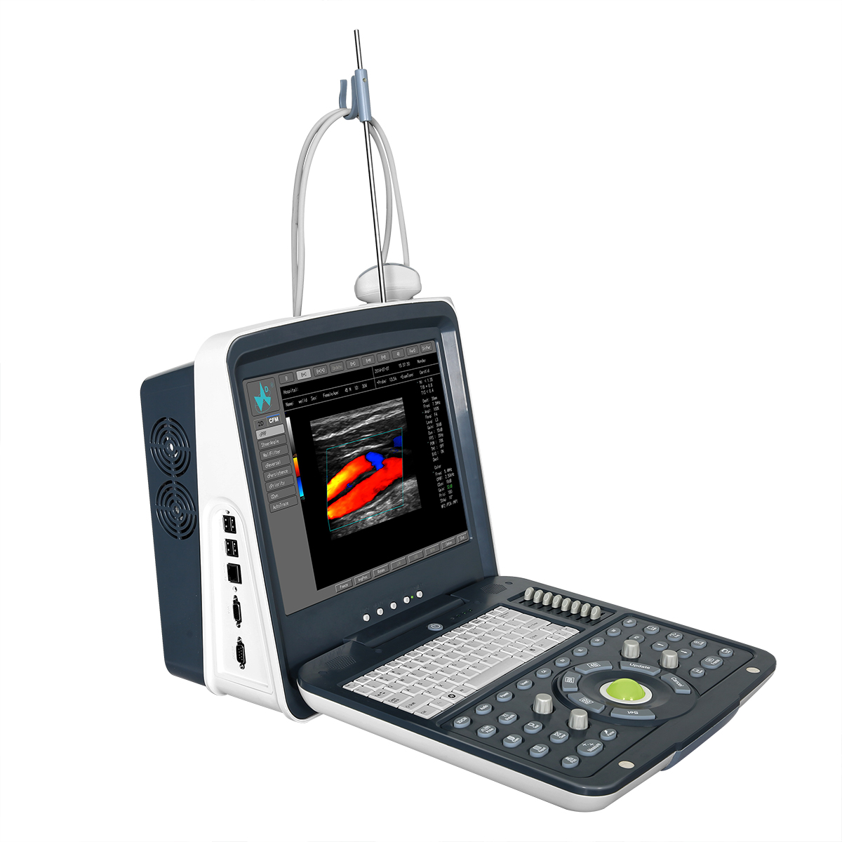 FDC6100 Sistema Diagnóstico de Ultrasonido Completamente digital de Color Doppler